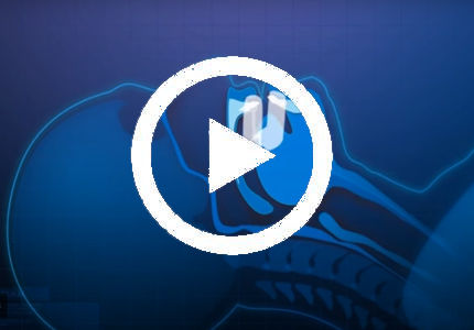 noa video